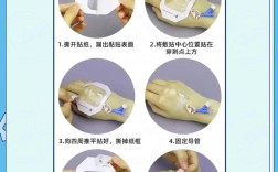静脉留置针护理参考文献