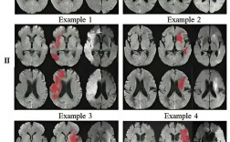 图像处理参考文献有哪些经典著作？
