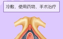 尿道球部损伤如何做好健康宣教？