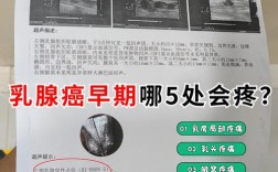 近5年乳腺癌研究有哪些新进展与突破？