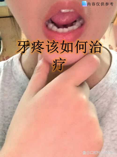 龋齿治疗研究文献有何新进展?-图3 龋齿治疗研究文献有何新进展?-图3