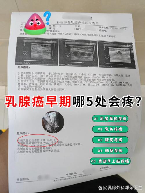 近5年乳腺癌研究有哪些新进展与突破?-图1 近5年乳腺癌研究有哪些新进展与突破?-图1