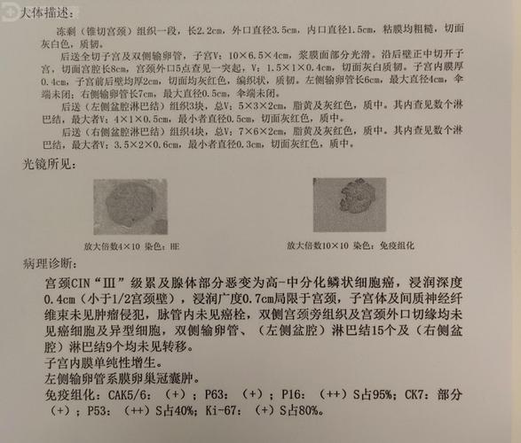 宫颈癌论文参考文献有哪些?-图1 宫颈癌论文参考文献有哪些?-图1