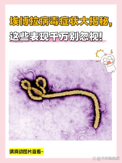 埃博拉病毒国外最新研究进展，从病毒学到临床治疗的探索与突破-图3