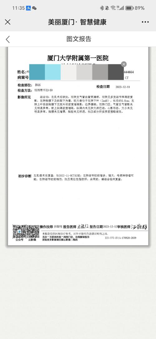 乳腺癌超声论文参考文献-图1