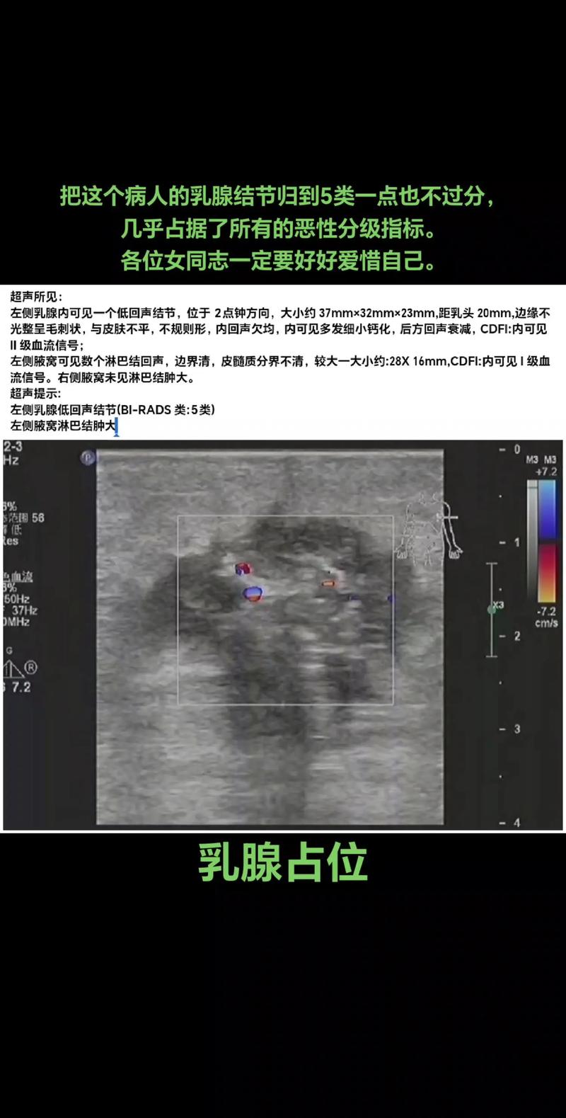 乳腺癌超声论文参考文献-图2