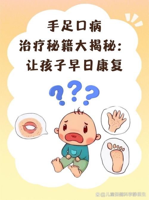 小儿手足口的健康教育-图3