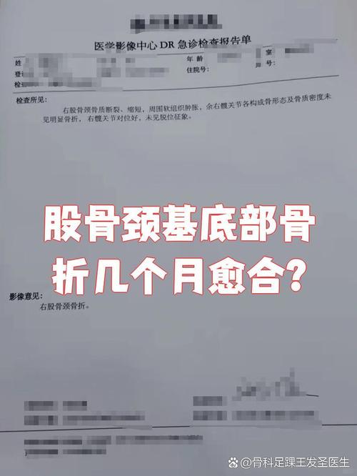 论文股骨颈骨折参考文献-图1