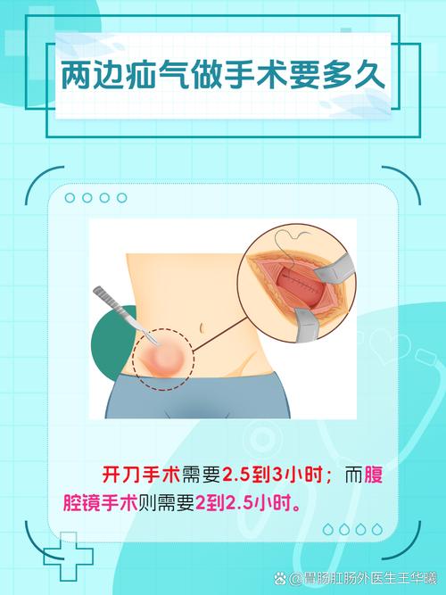 疝气围手术期健康教育怎么做？-图3