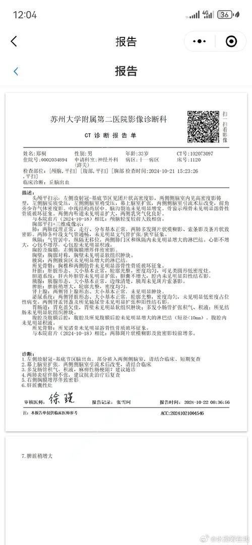 脑出血论文参考文献有哪些?-图2 脑出血论文参考文献有哪些?-图2